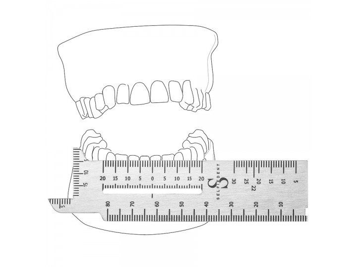 Линейка стоматологическая (ортодонтическая) ЛН.01