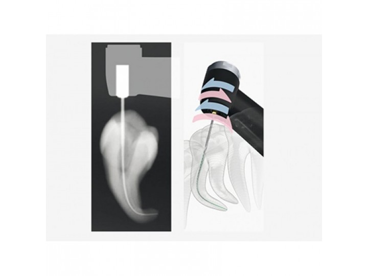 Три Авто ZX2 - Tri Auto ZX2