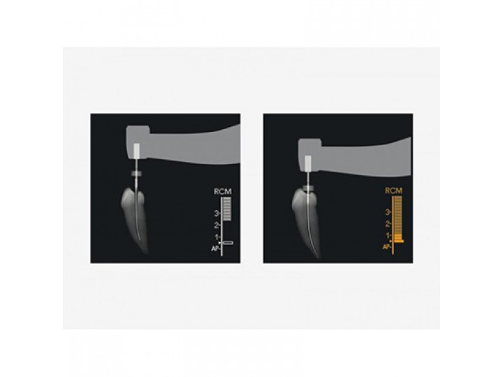 Три Авто ZX2 - Tri Auto ZX2