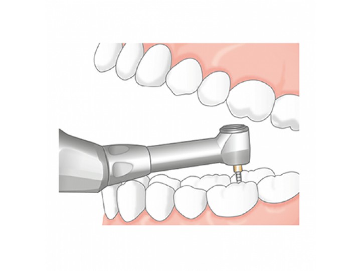 Эндо Мейт TC2 MP-Y - Endo-Mate TC2