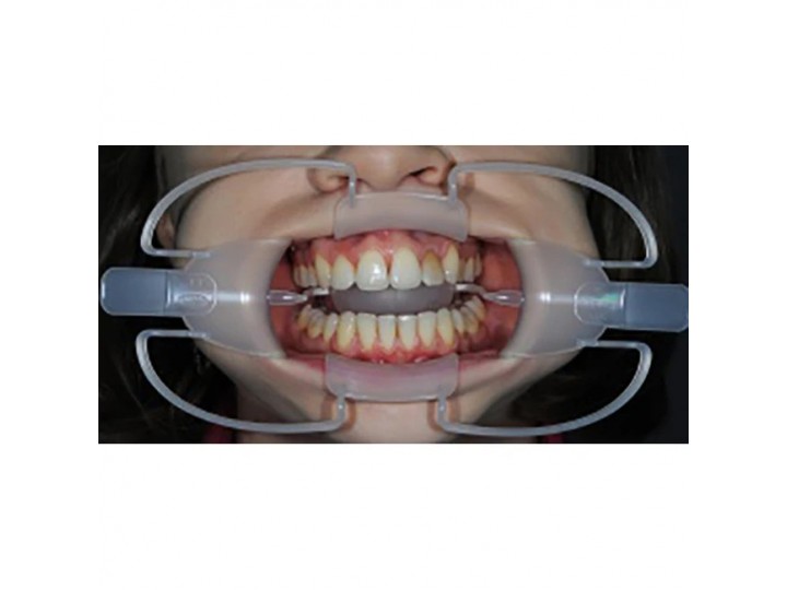 Роторасширитель 4-х сторонний с блокировкой языка YDM
