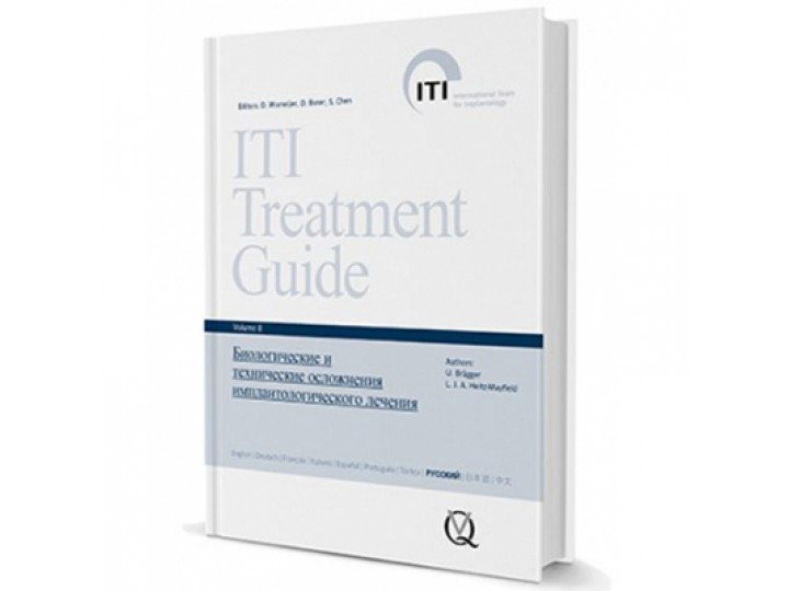 Биологические и технические осложнения имплантологического лечения, ITI том 8