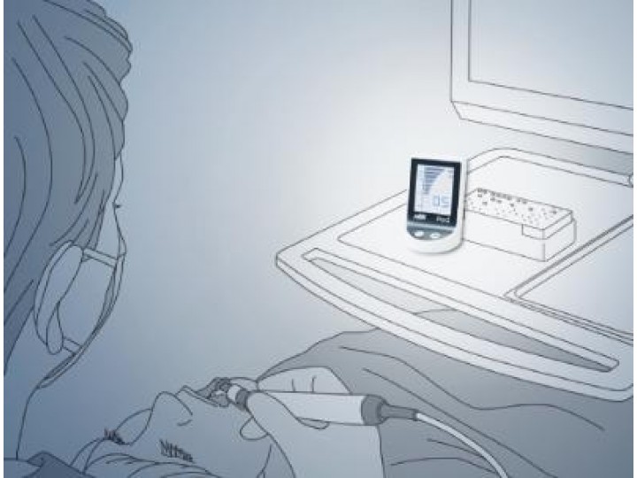 Апекслокатор iPex II