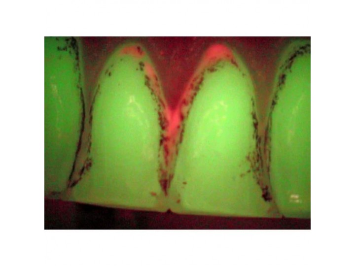 VistaCam IX - интраоральная видеокамера, подключается к USB ПК, с насадками Cam, Proof, Proxi