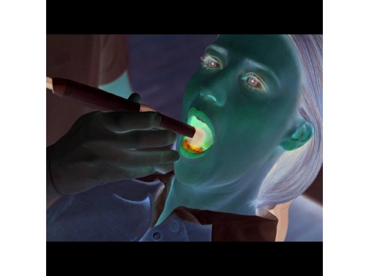 VistaCam IX - интраоральная видеокамера, подключается к USB ПК, с насадками Cam, Proof