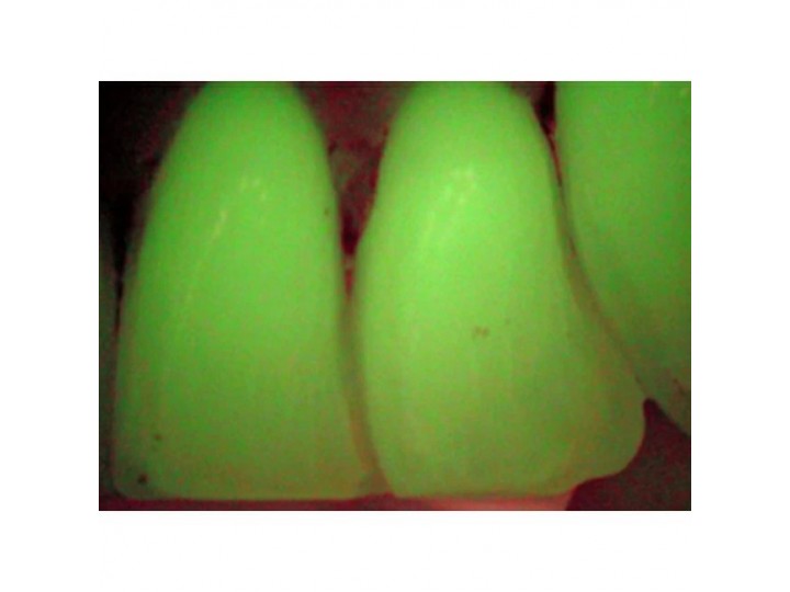 VistaCam IX - интраоральная видеокамера, подключается к USB ПК, с насадками Cam, Proof