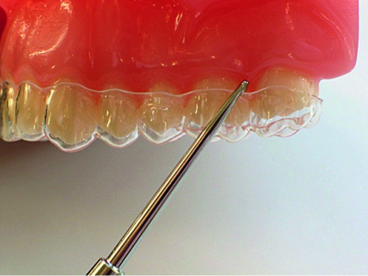 HSL 265-07 - инструмент для снятия ортодонтических элайнеров Easy Lift