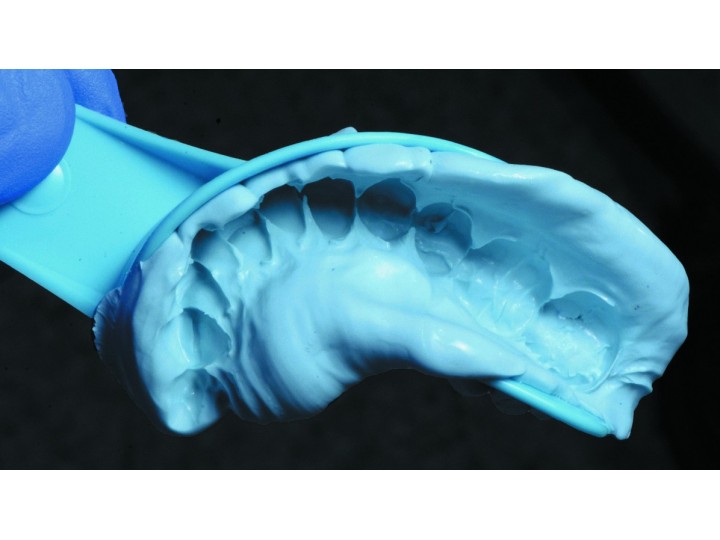 Акцесс Блу - Access Blue