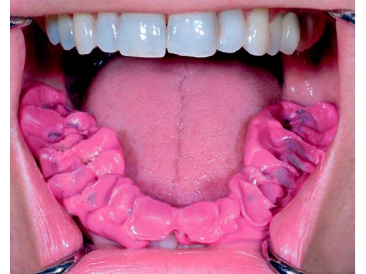 Футар Д - Futar D