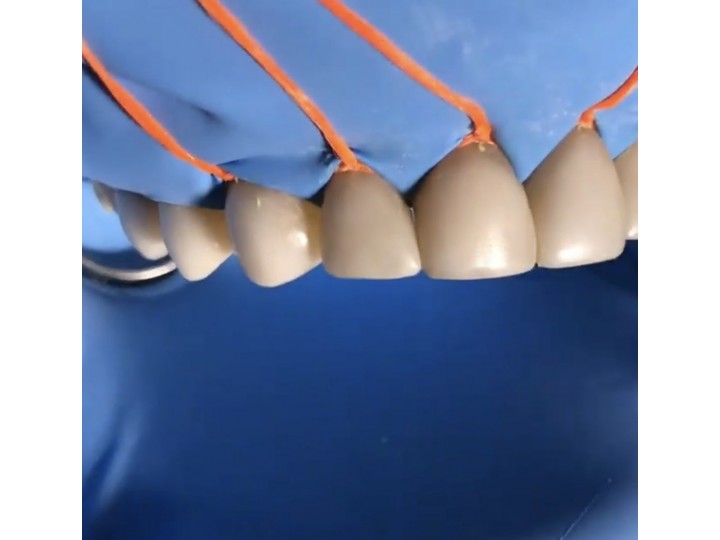 Фиксофлосс, нить для фиксации коффердама (70м) EdelWhite