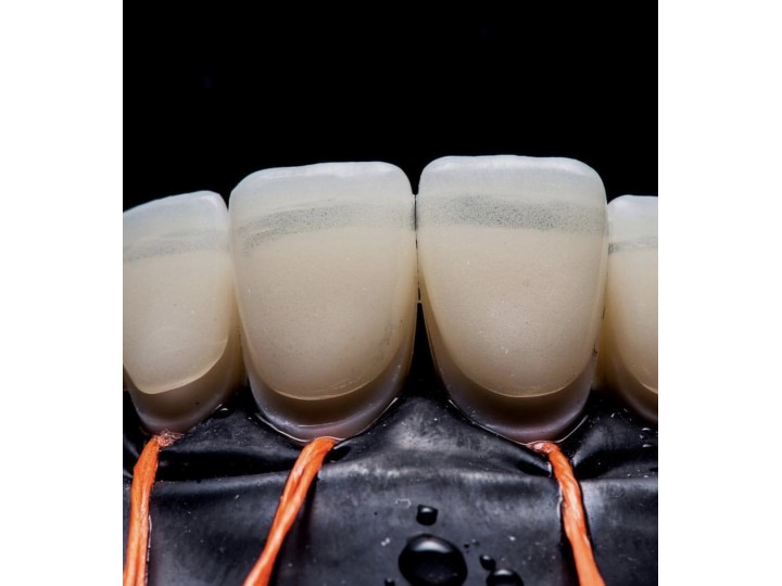 Фиксофлосс, нить для фиксации коффердама (70м) EdelWhite