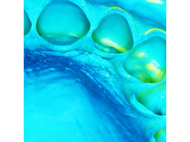 Элит Лайт фаст - Elite НD + Light Body Fast Set