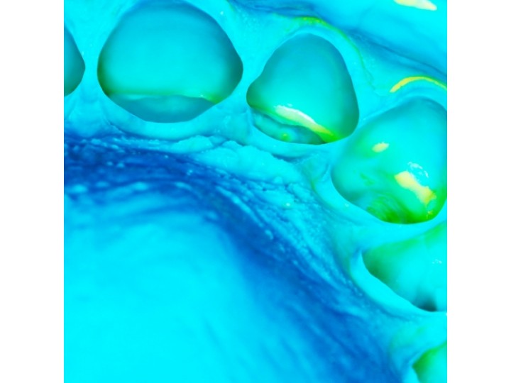 Элит Патти нормал эконом (4х450мл) - Elite HD+ Putty Soft Normal Set ECO