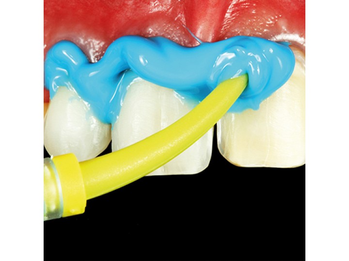 Элит Лайт нормал - Elite НD + Light Body Normal Setting