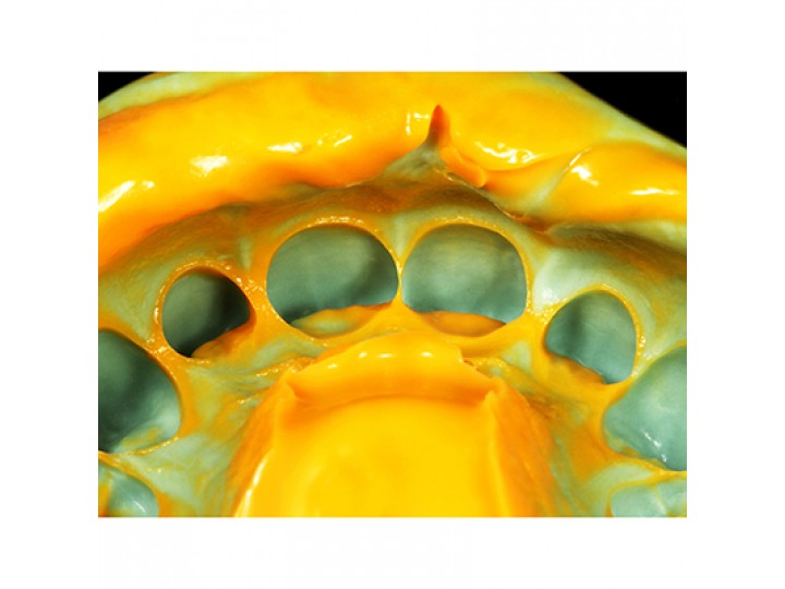 Оранвош Л корригирующий слой - Oranwash L Zetaplus