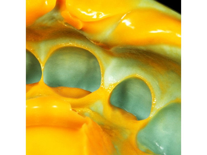 Зетаплюс базовый слой - Zetaplus