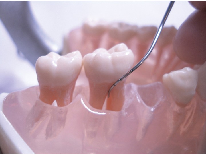 Зонд пародонтальный Furcation, 09202