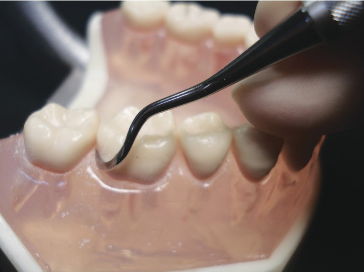 Инструмент для снятия зубных отложений Slim #2, 09412