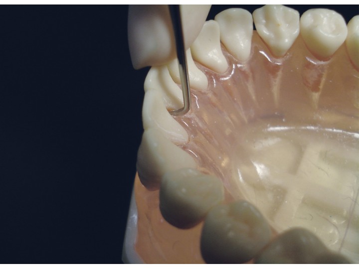 Инструмент для снятия зубных отложений Slim #1, 09411