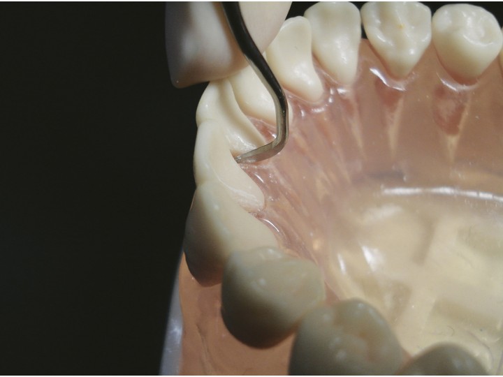 Инструмент для снятия зубных отложений Slim #1, 09411