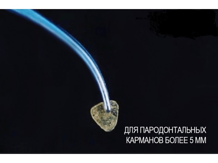 М-чип Наноматрица  M-Chip 15шт. - пластинки для дёсен (стерильные)