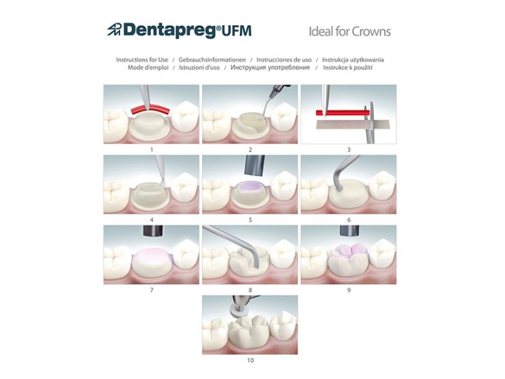 Шинирующая сетка Dentapreg UFM - Дентапрег Шинирующая сетка Dentapreg UFM - Дентапрег