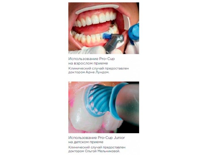 Чашечки Pro-Cup Latch-Type жесткие 991/120