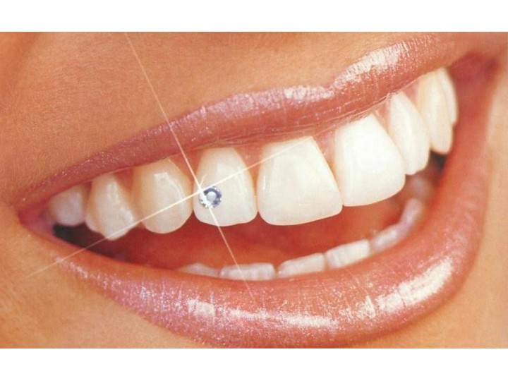 Набор скайсов