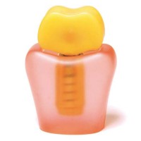 Демонстрационная модель Demo Implant