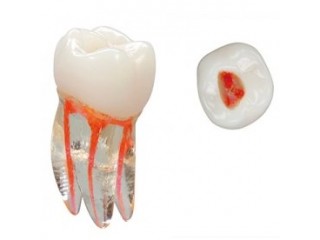 Эндо Трейнер Зуб - Endo Training Tooth