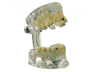 Демонстрационная модель, прозрачная (ребенок)