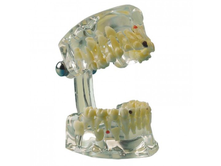 Демонстрационная модель, прозрачная (ребенок)