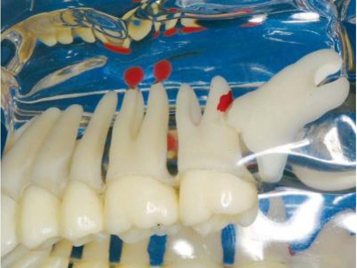 Демонстрационная модель, прозрачная De Luxe