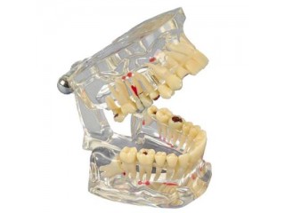 Демонстрационная модель, прозрачная De Luxe