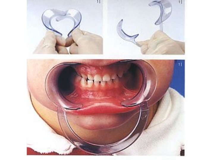 Роторасширитель