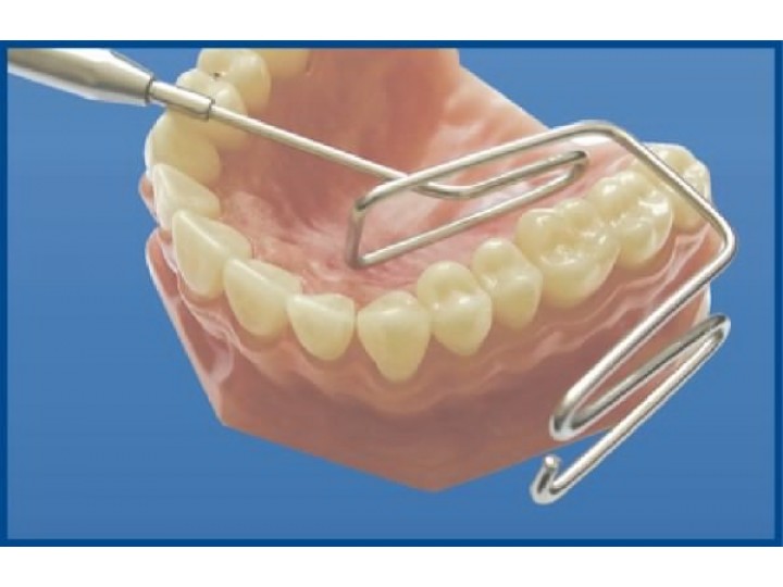 Ретрактор с резьбовым соединением для ручки 1.019