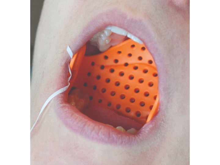 Сетка для изоляции