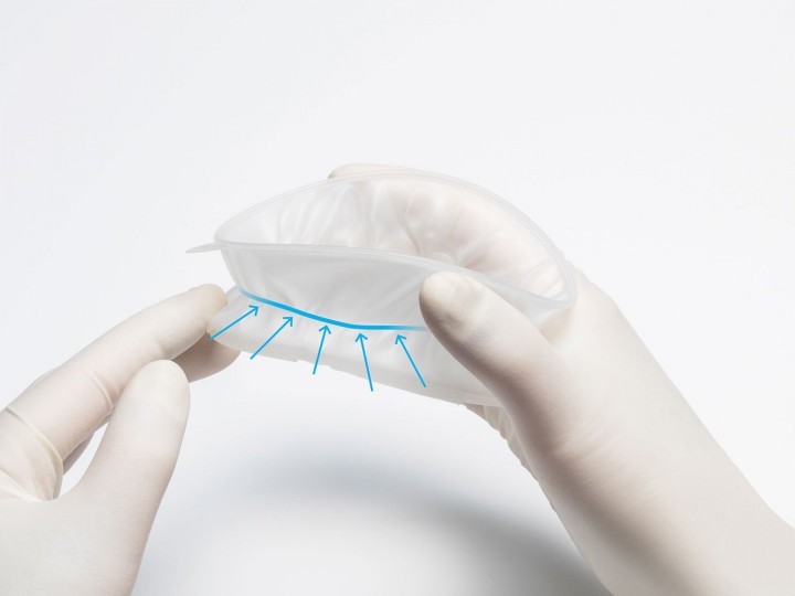 Роторасширитель Оптрагейт 2 - OptraGate 2 Regular (1 шт)