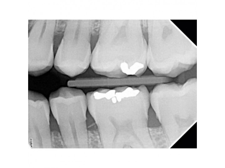 X-Mind DC Mobile - мобильный дентальный рентгеновский аппарат