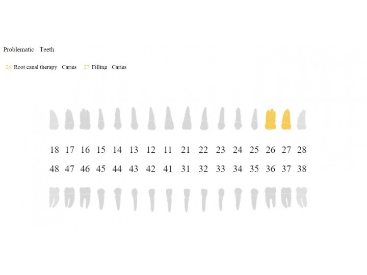 Комплект: портативный рентген HyperLight + визиограф NANOPIX 2, Eighteeth