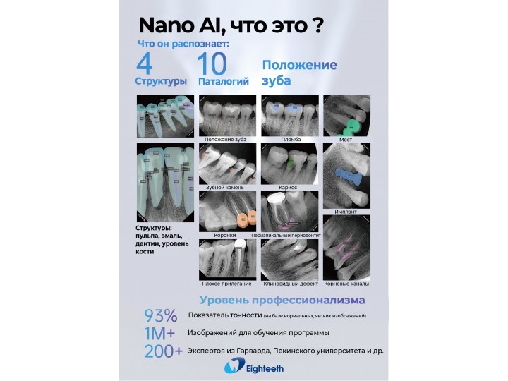 Визиограф NanoPix2, Eighteeth