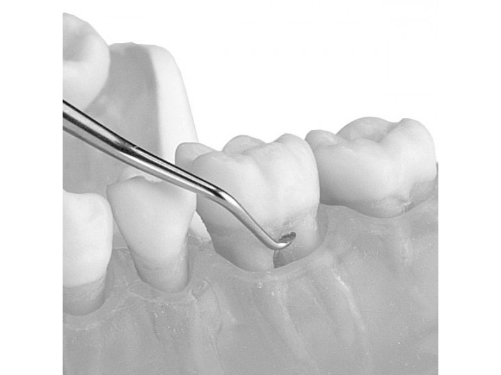 Обратный круглый экскаватор, 1,0 мм LM 611-621