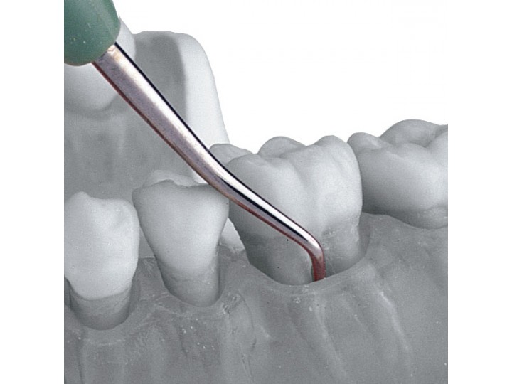 Обратный круглый экскаватор, 2,0 мм LM 651-661