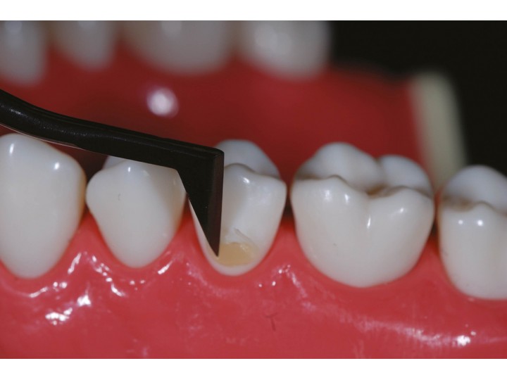 Инструмент для композитов #4 серии TMDU, 03344