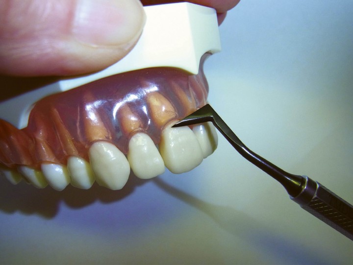 Инструмент для композитов TMDU2 #4, 03394