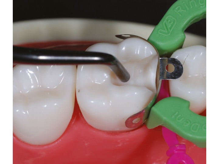 Инструмент для композитов серии TMDU #1, 03341