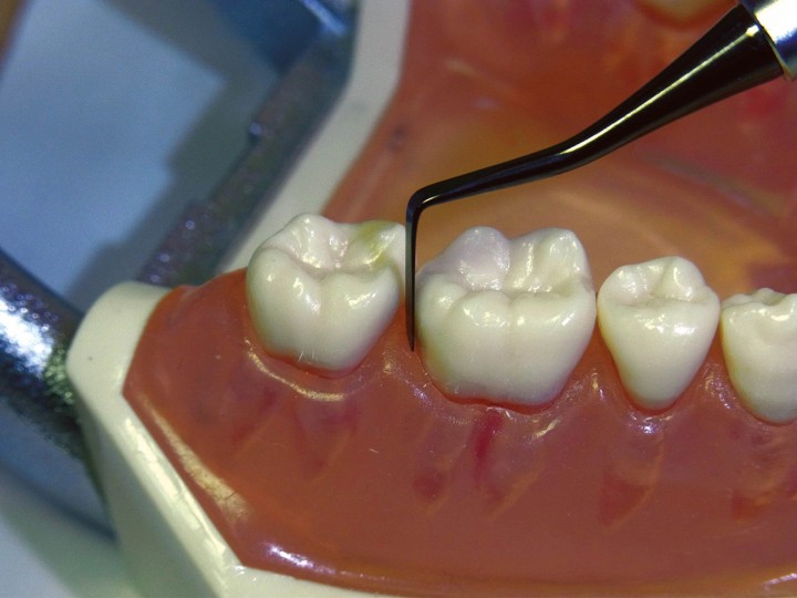 Инструмент для композитов TMDU2 #1, 03391