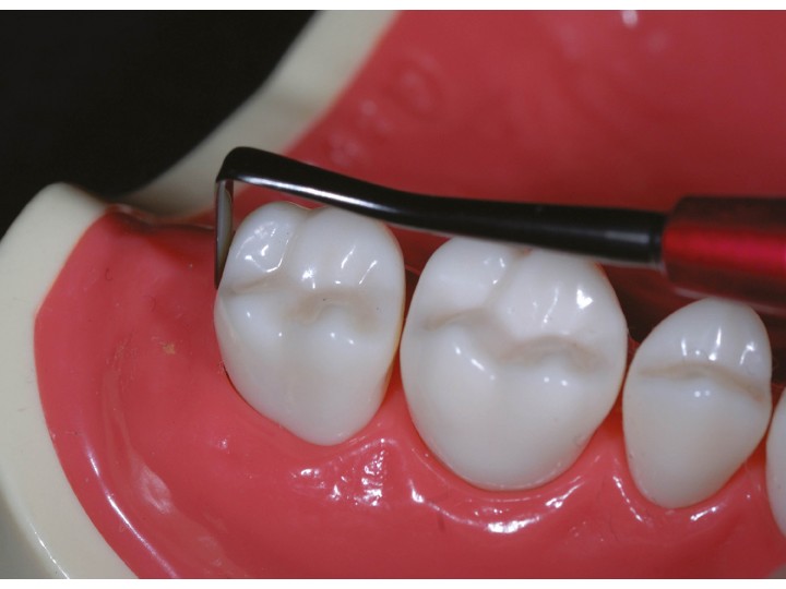 Инструмент для композитов серии TMDU #3, 03343