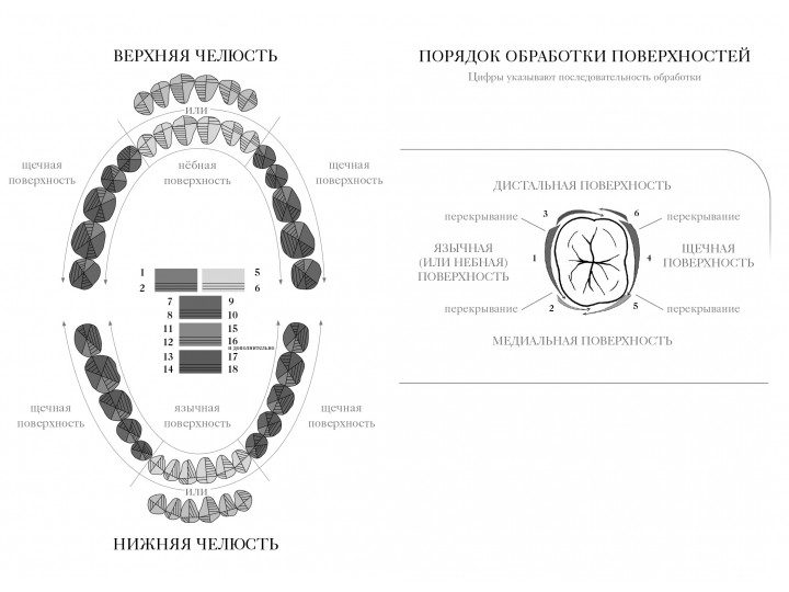 Кюреты Грейси (Gracey) After Five