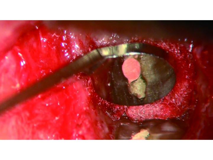 Зеркало хирургическое Micro #4, 14904